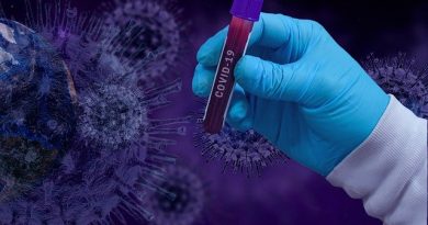 V Celju včeraj manj okužb. Bolnišnice v naslednjih tednih čakajo zahtevne razmere V Celju včeraj manj okužb. Bolnišnice v naslednjih tednih čakajo zahtevne razmere